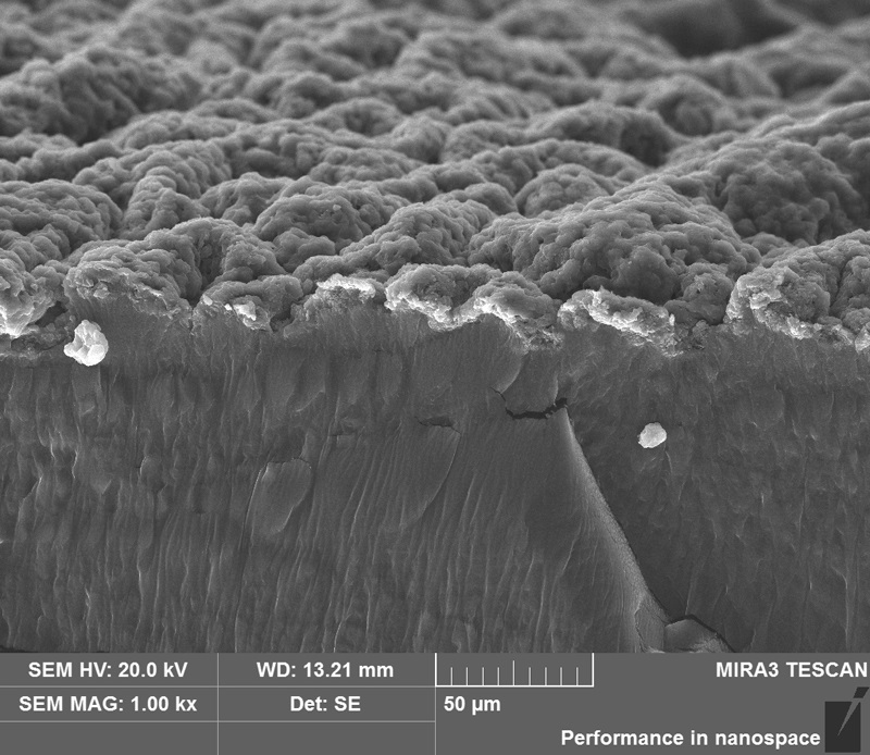 Biomass-based hydrogel antibacterial wound dressing