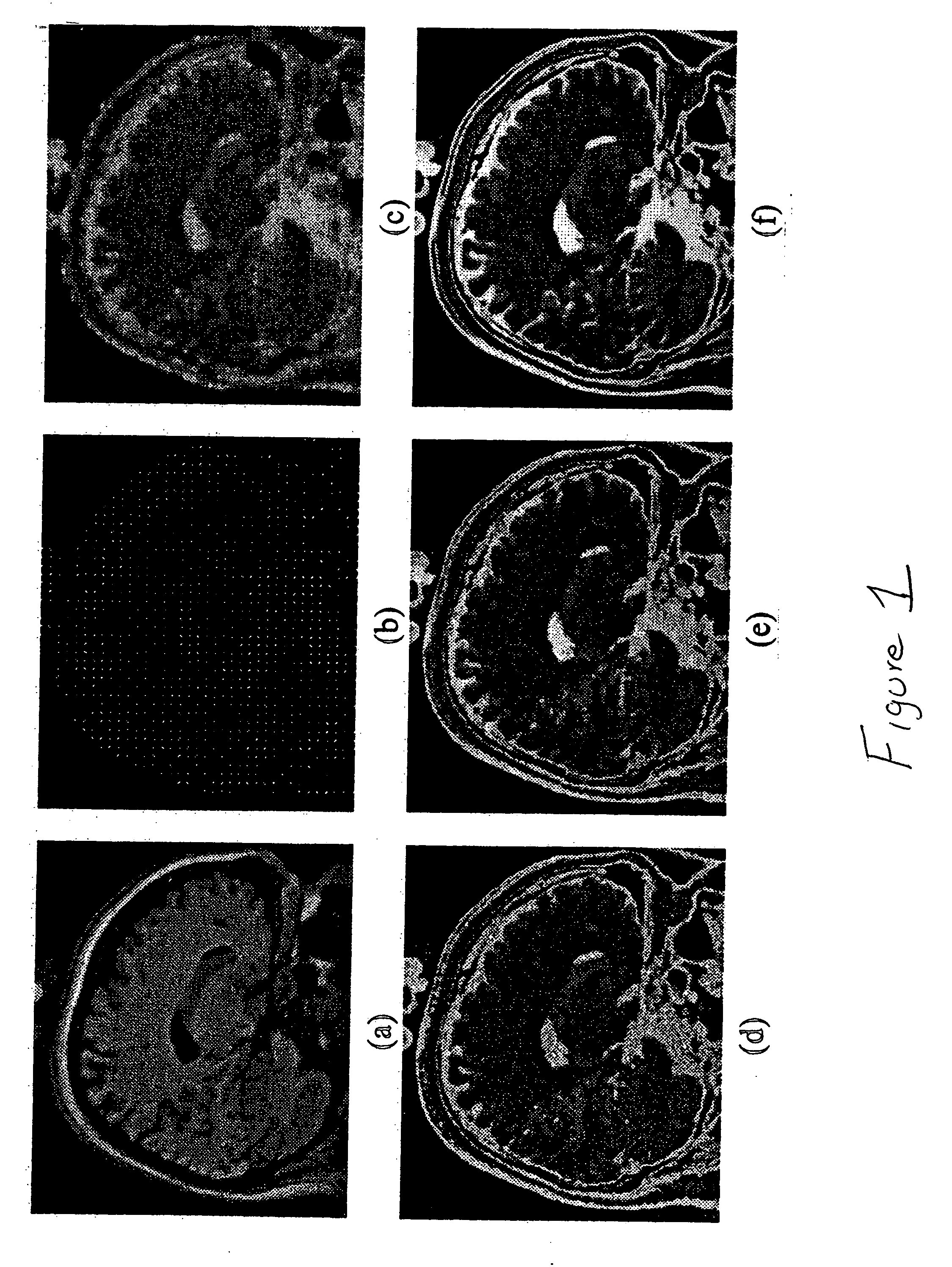 Method and apparatus for propagating high resolution detail between multimodal data sets