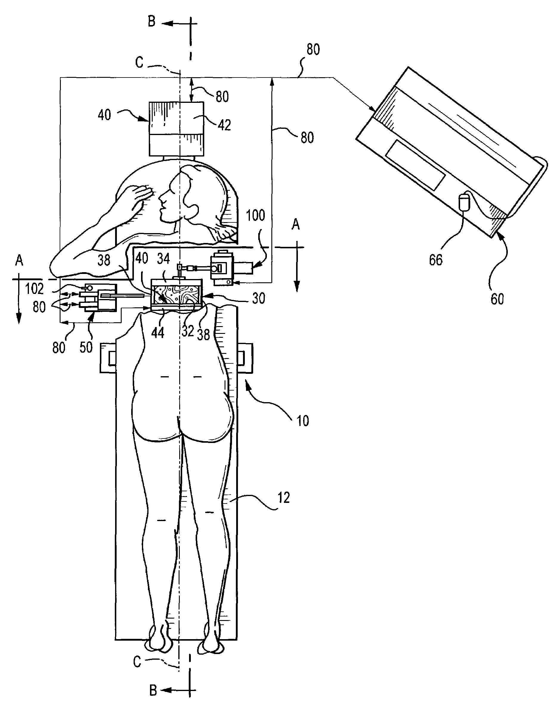Spatially correlated x-ray and ultrasound mammographic imaging systems and method