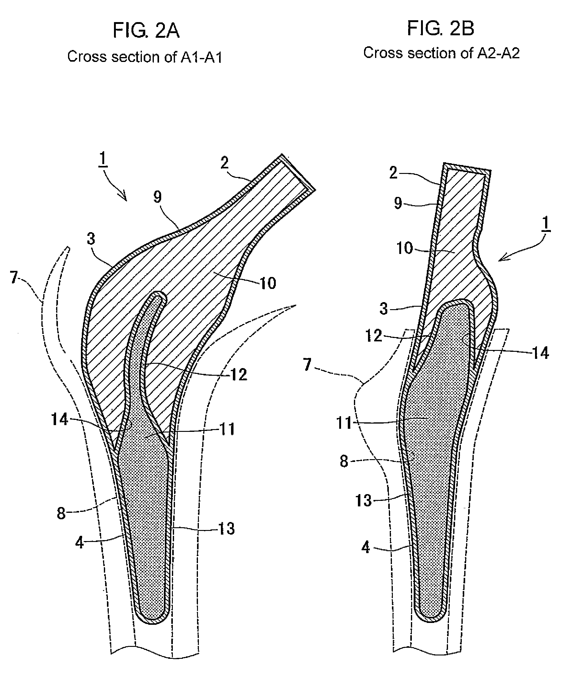 Method of Designing and Manufacturing Artificial Joint Stem with Use of Composite Material