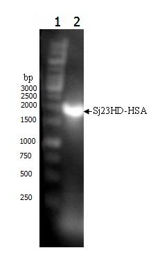 Schistosoma japonicum 23kDa membrane protein big hydrophilic peptide segment fusion protein and application thereof in schistosome infection immune diagnosis