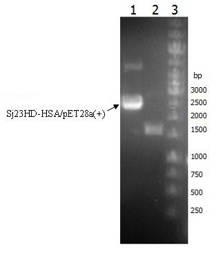 Schistosoma japonicum 23kDa membrane protein big hydrophilic peptide segment fusion protein and application thereof in schistosome infection immune diagnosis