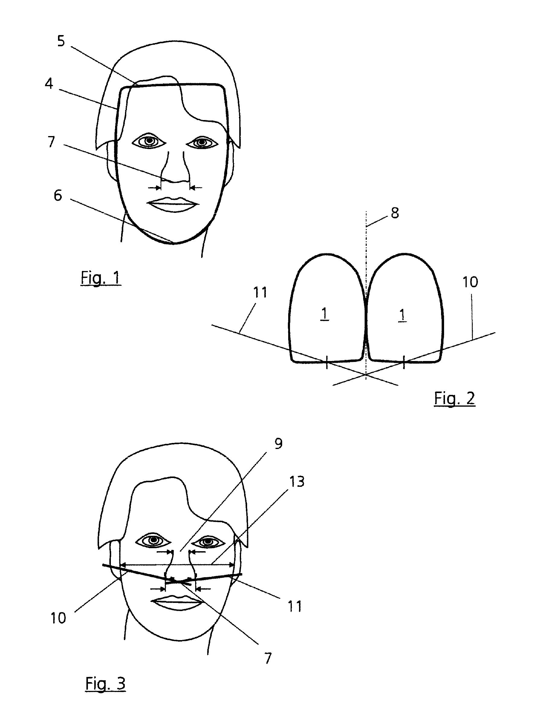 Method for reconstruction of teeth