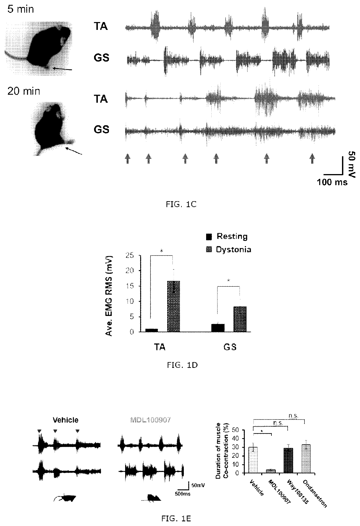 Novel method of treating dystonia