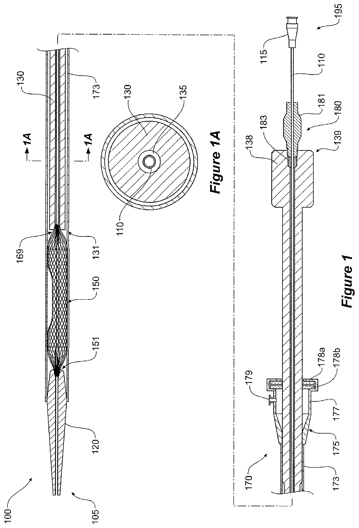 Medical device for temporary deployment into a bodily lumen