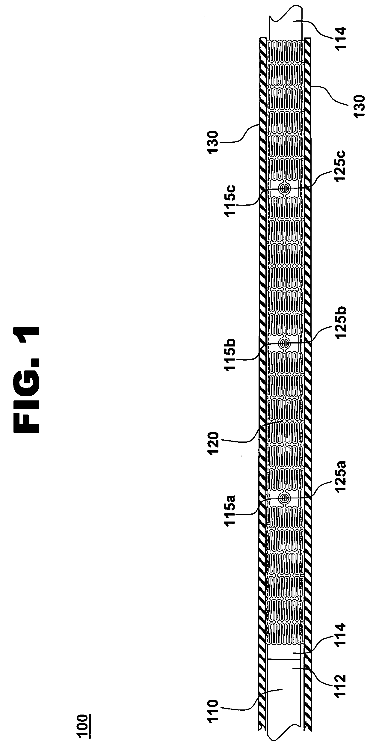 Force distributing system for delivering a self-expanding stent
