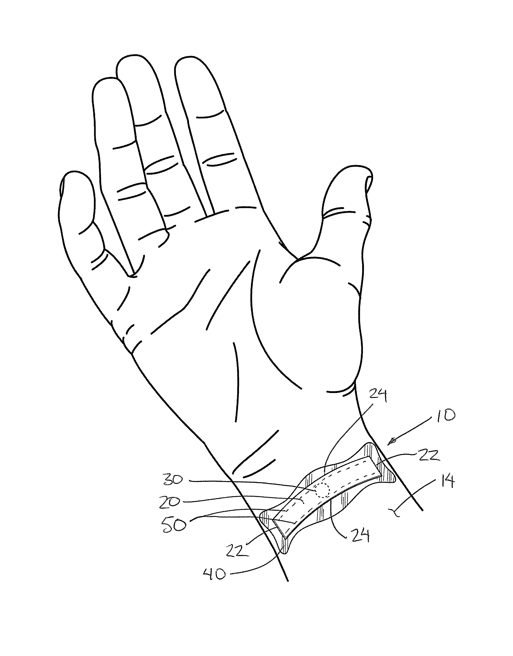 Acupressure Device