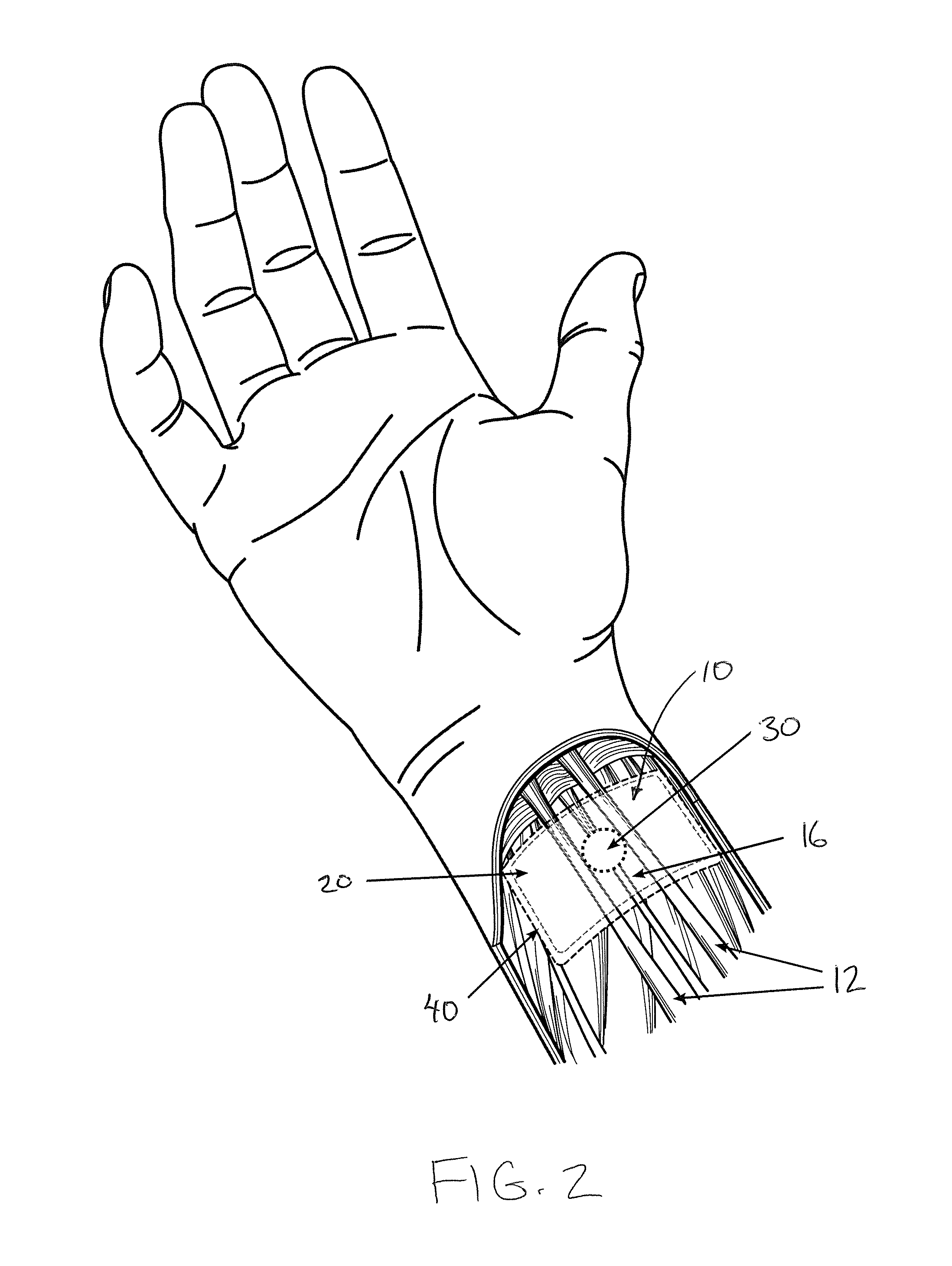 Acupressure Device