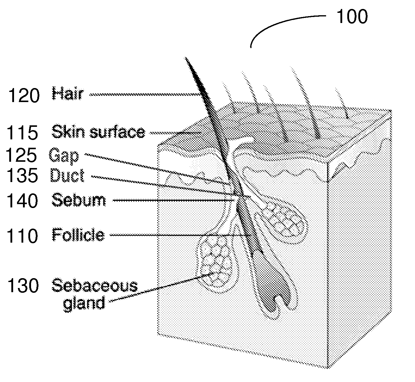Method and apparatus for dermal delivery of a substance