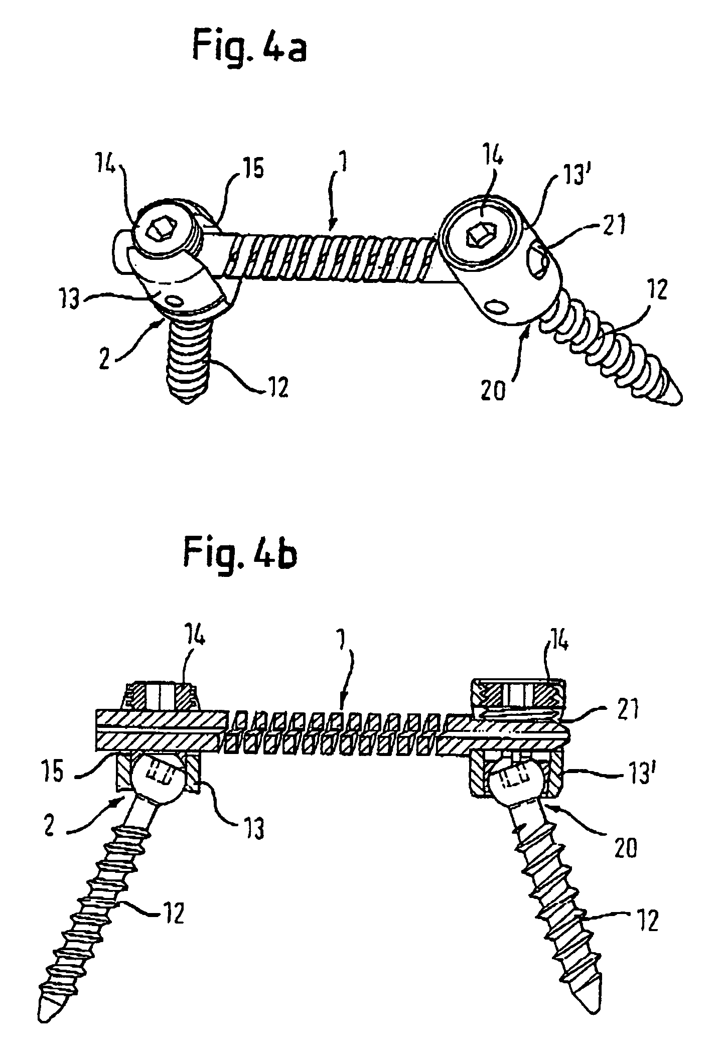 Rod-shaped implant element with flexible section