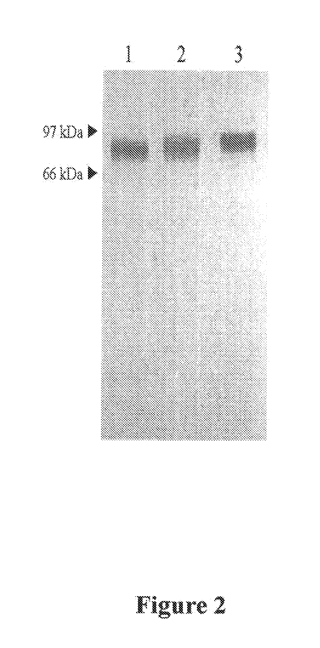 Compositions and methods for treating hypophosphatasia