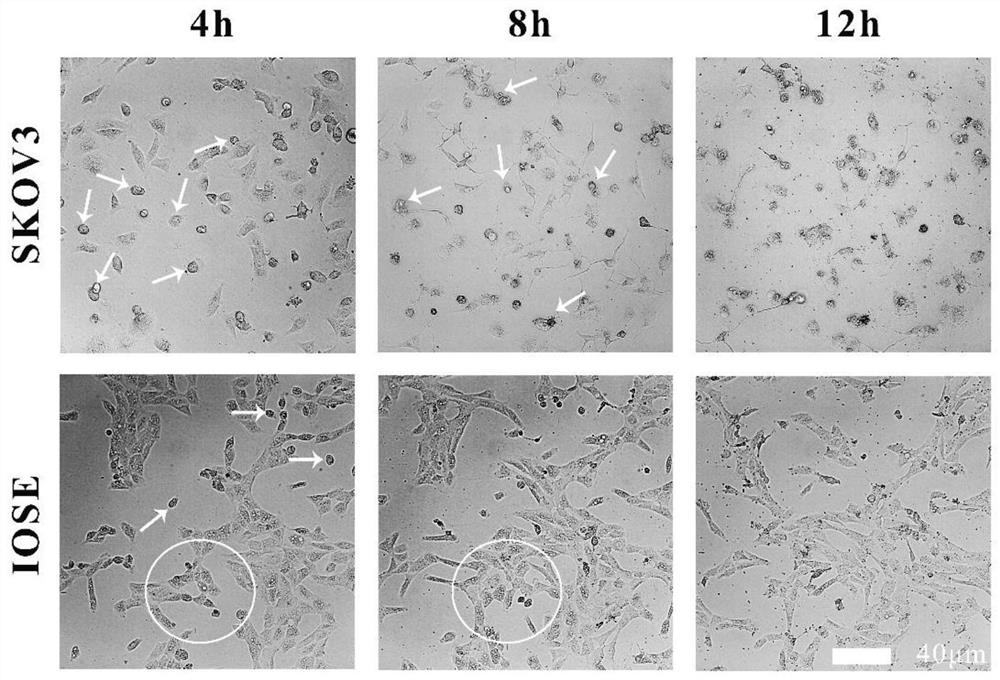 Application of N&lt;n&gt;-acylamino acid ester in preparation of antitumor drug