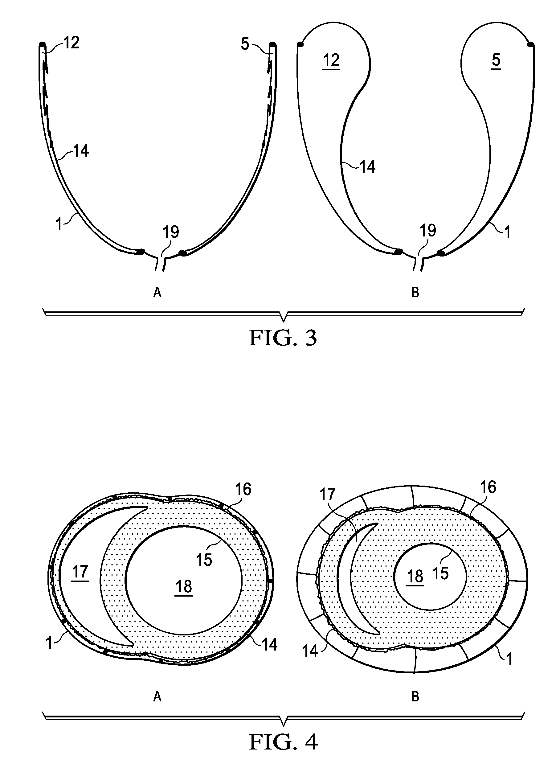 Biphasic and Dynamic Adjustable Support Devices and Methods with Assist and Recoil Capabilities for Treatment of Cardiac Pathologies