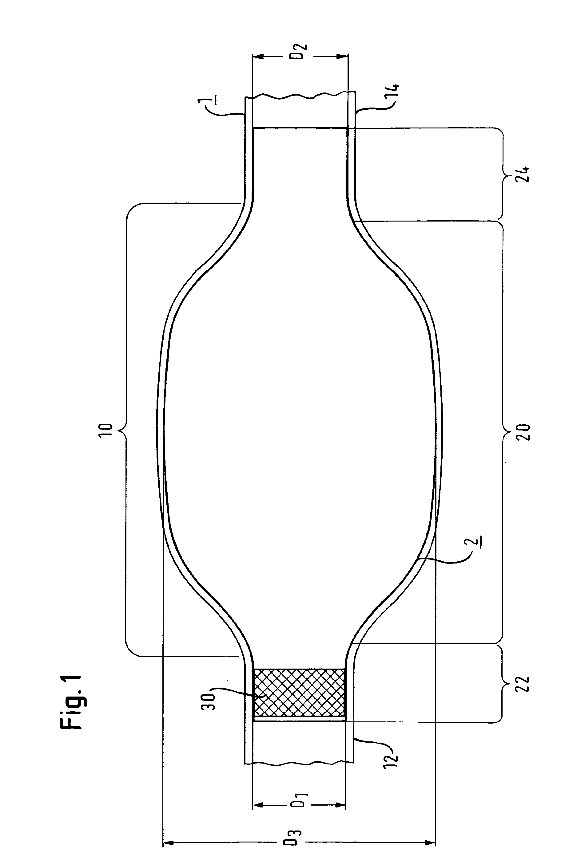 Vascular Prosthesis for Aneurysms, Set of Vascular Prostheses, Method for Manufacturing a Vascular Prosthesis and Method for Inserting a Vascular Prosthesis