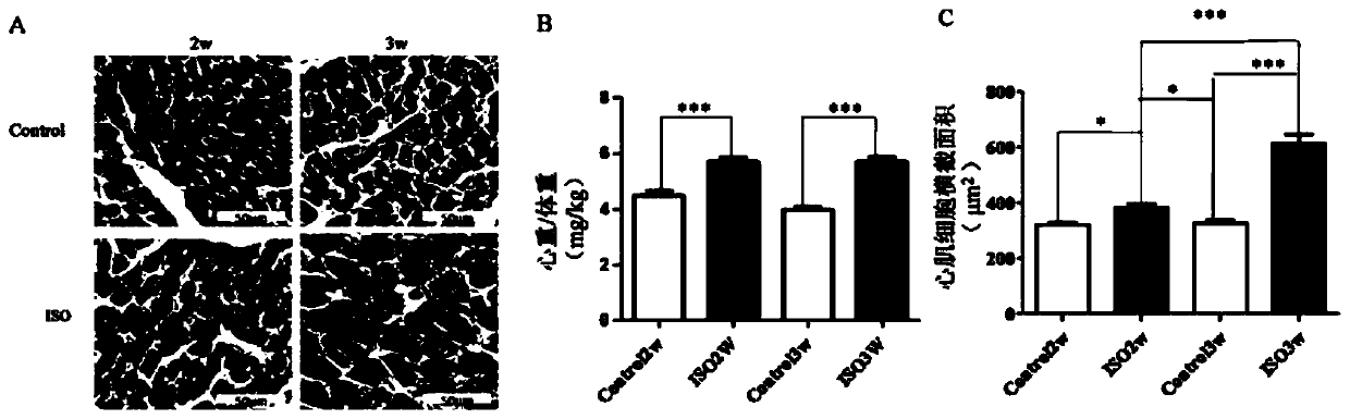 A class of polypeptide drug athycaltide and its application