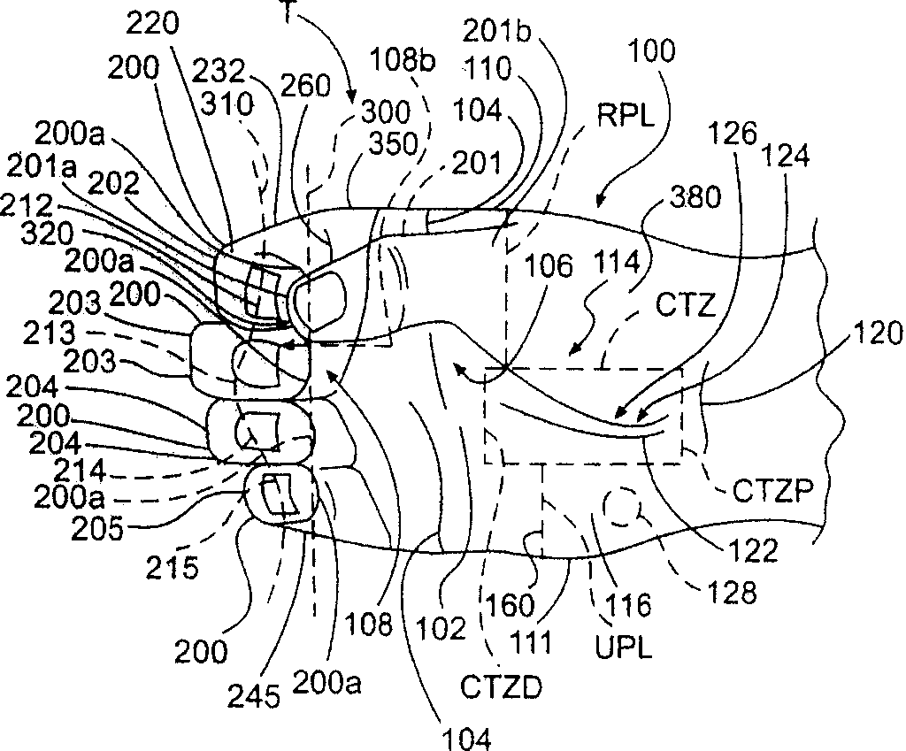 A parallel handle system  and method for designing the like