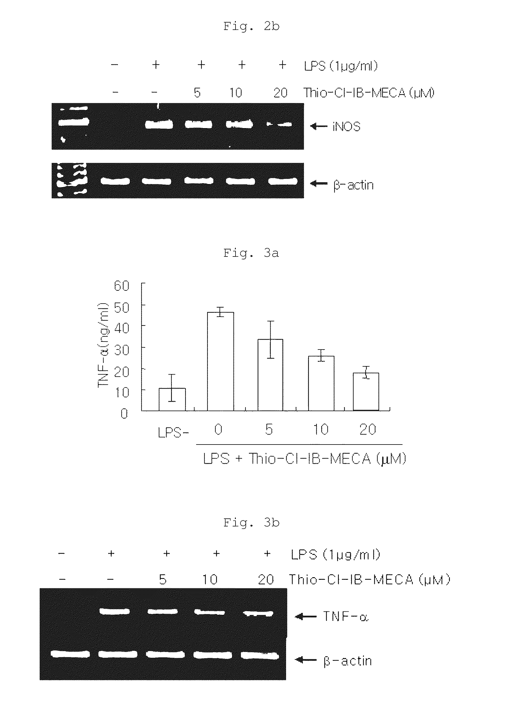 Method for treating prostate cancer by use of pharmaceutical composition containing a3 adenosine receptor agonist
