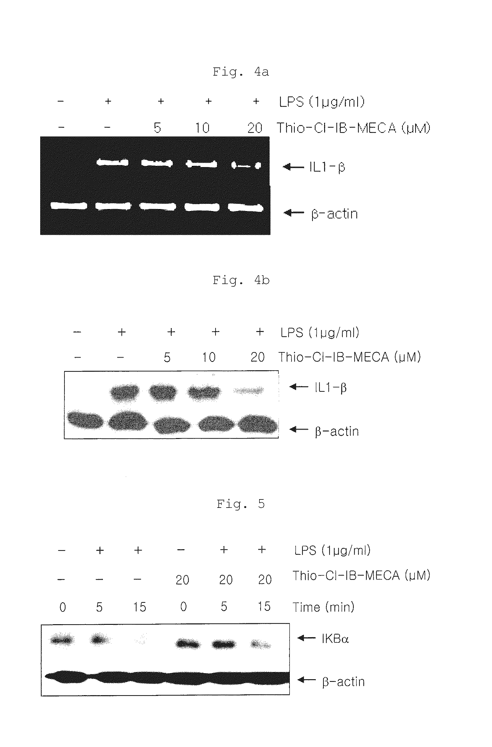Method for treating prostate cancer by use of pharmaceutical composition containing a3 adenosine receptor agonist