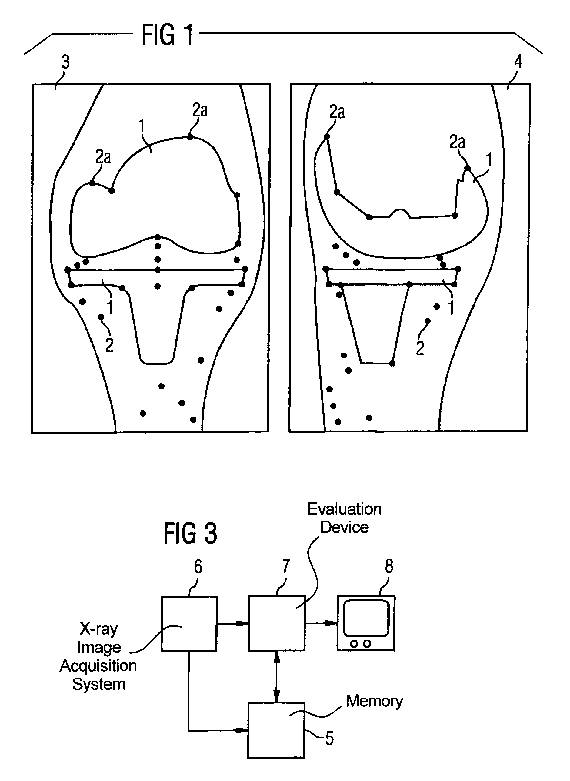 Method and x-ray system for detecting position changes of a medical implant