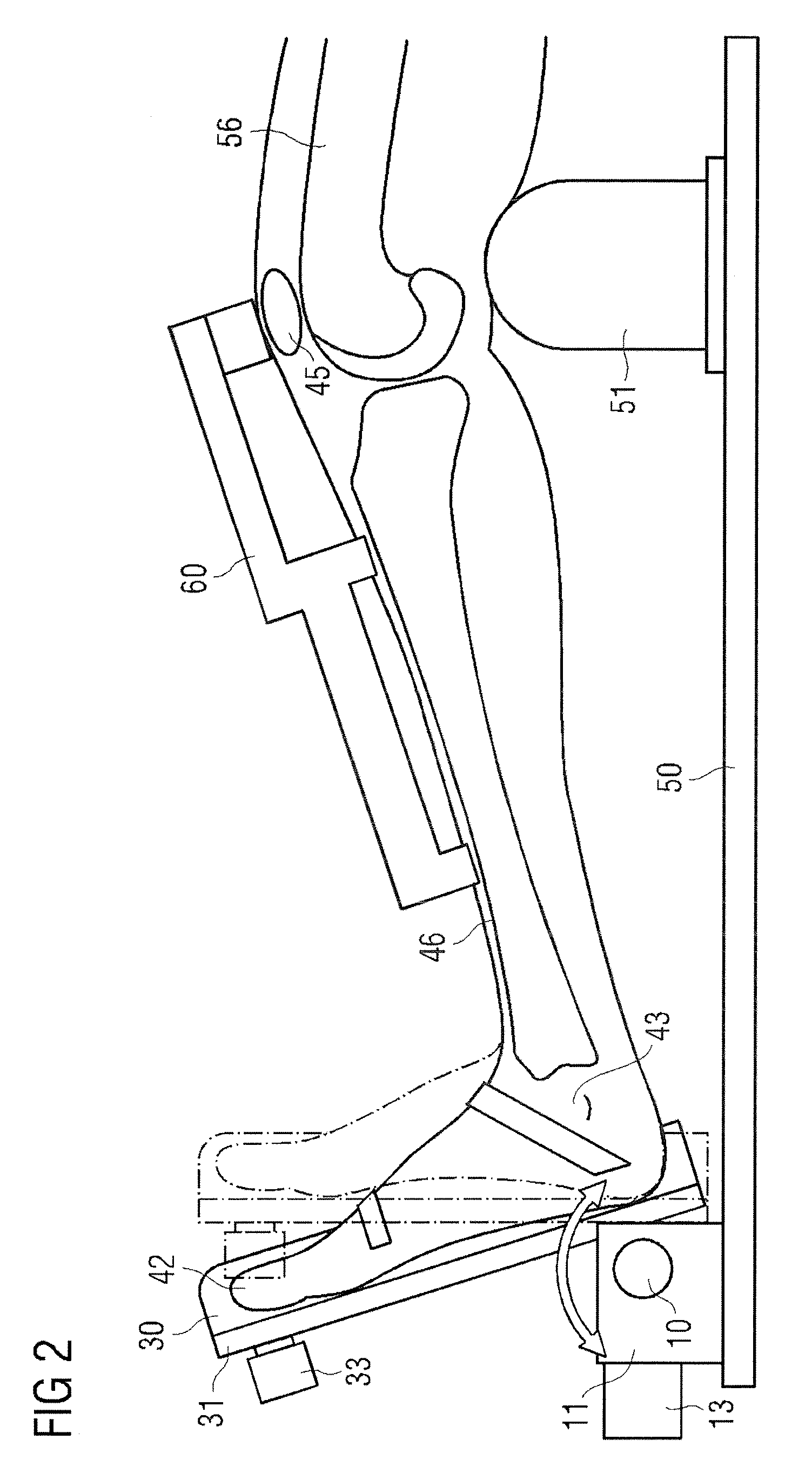 Device and method for knee ligament strain measurement