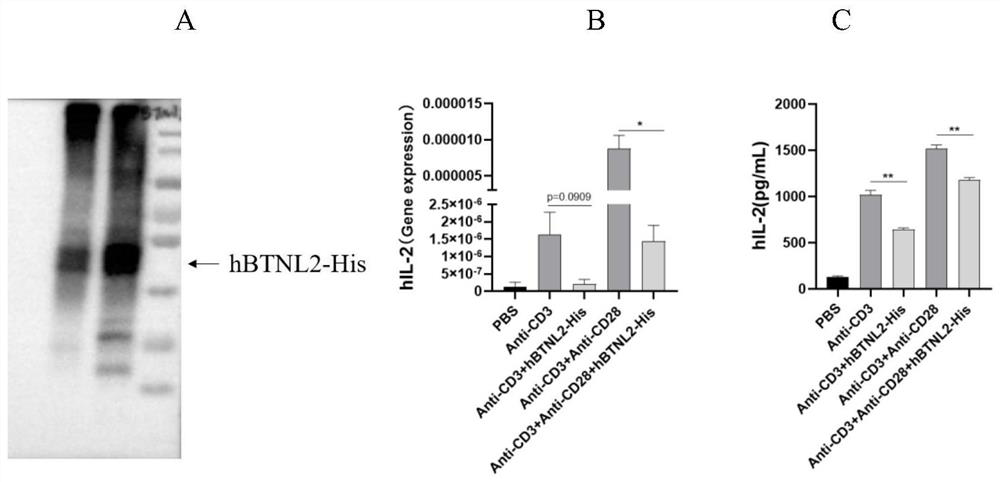BTNL2 recombinant protein, preparation method thereof and application of BTNL2 recombinant protein in preparation of medicine for treating inflammatory bowel disease