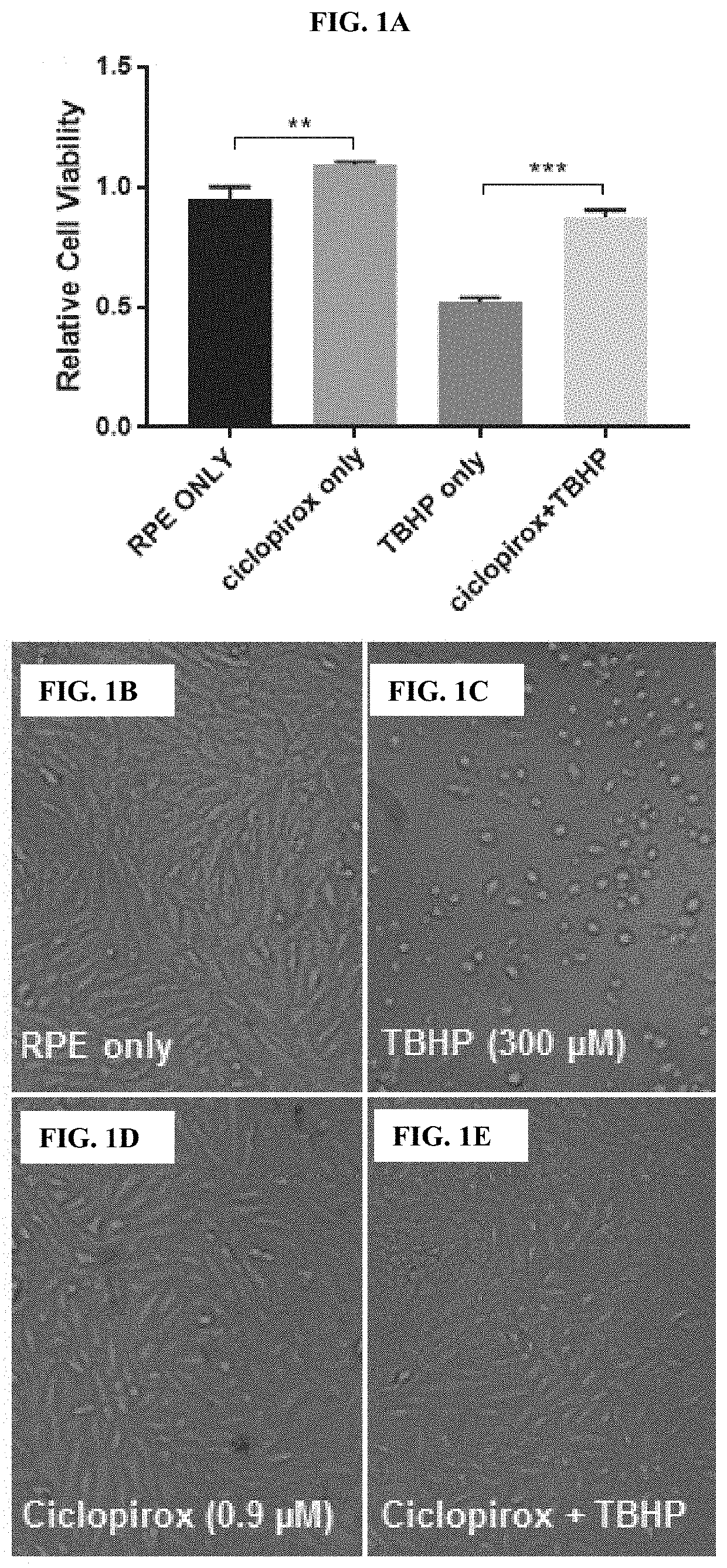 Compounds and Methods for Treating or Preventing Anterior Segment Ocular Disorders and/or Retinal Degenerations