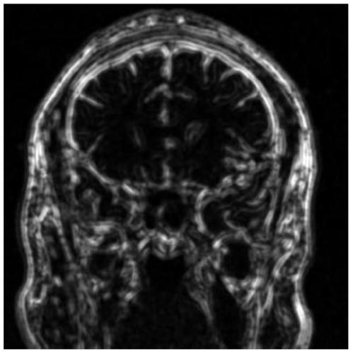 A medical image processing method and system