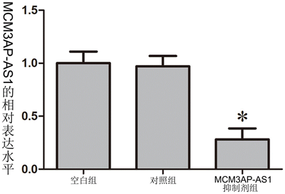 Targeting inhibitor for MCM3AP-AS1 gene and application of targeting inhibitor