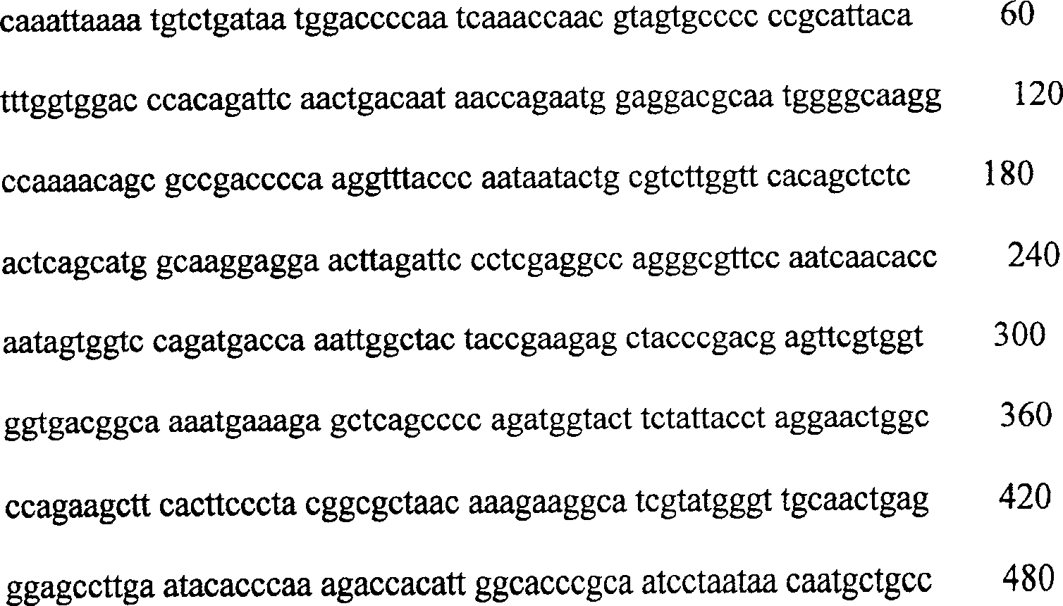 Gene vaccine against SARS virogene and its construction and use