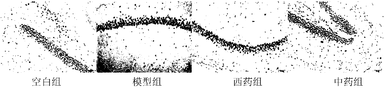 Traditional Chinese medicine composition for treating Parkinson's disease and preparation method and application thereof