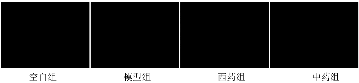 Traditional Chinese medicine composition for treating Parkinson's disease and preparation method and application thereof