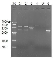 Construction and application of PhoPR gene overexpressed BCG strain