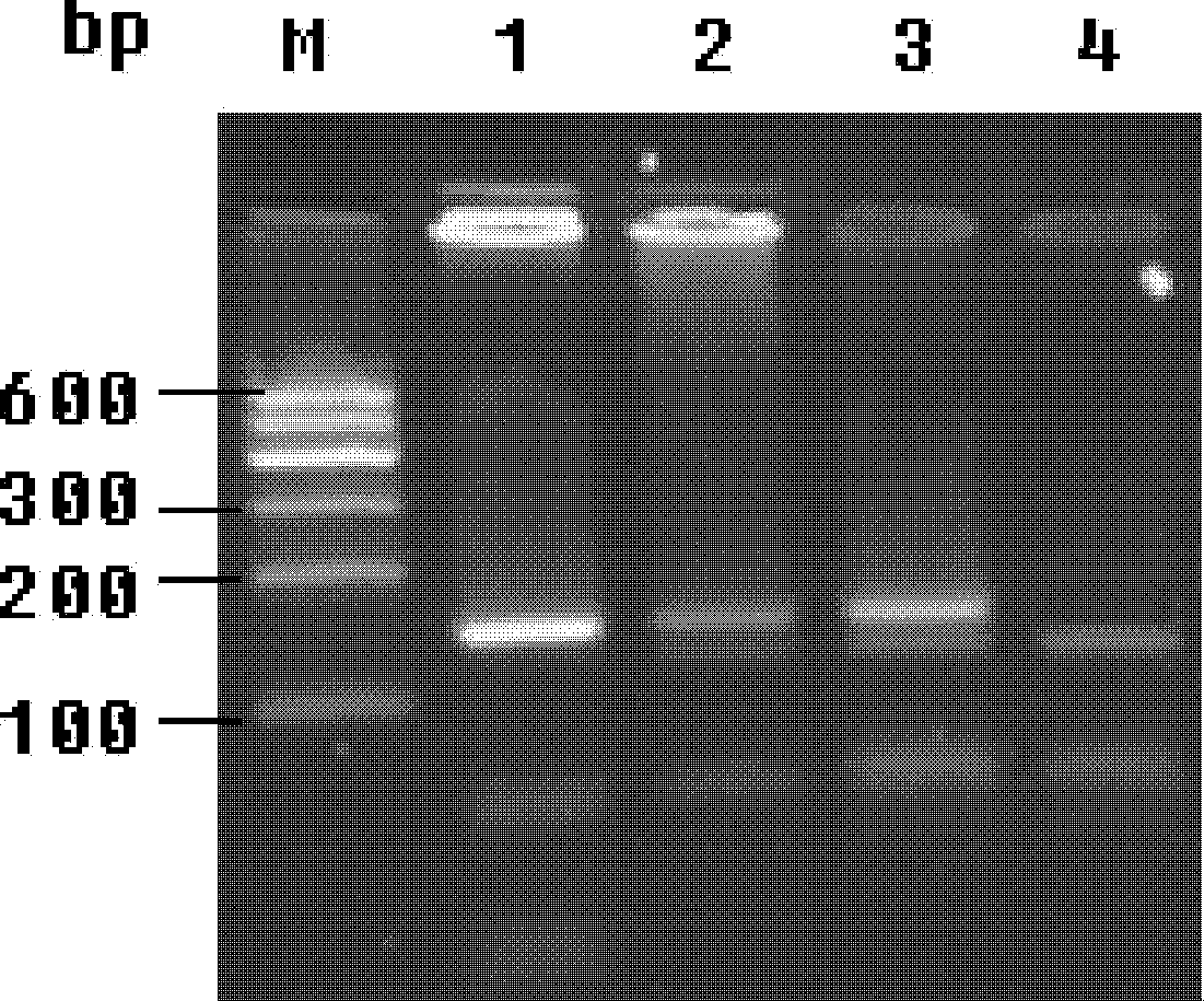 Human paraoxonase (PON) 2 gene 148 site G/A polymorphic detection kit