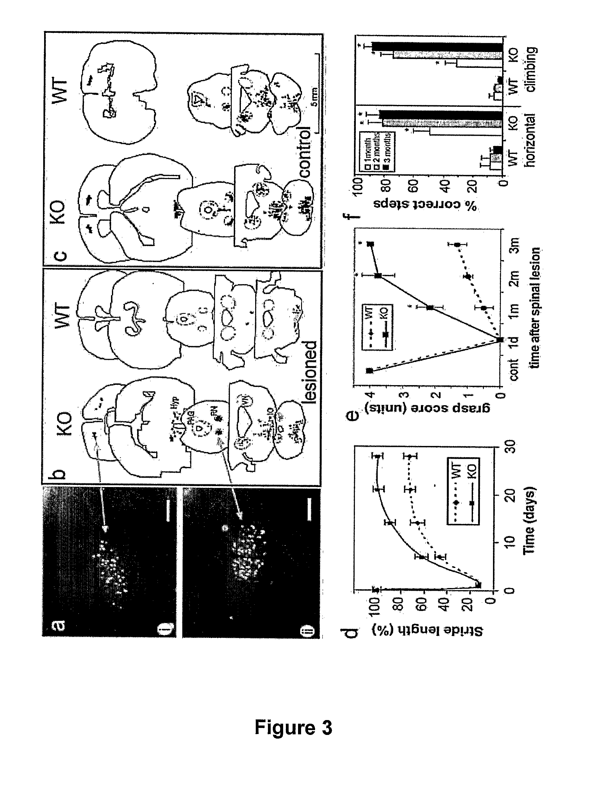 Treating Gliosis, Glial Scarring, Inflammation or Inhibition of Axonal Growth in the Nervous System by Modulating Eph Receptor