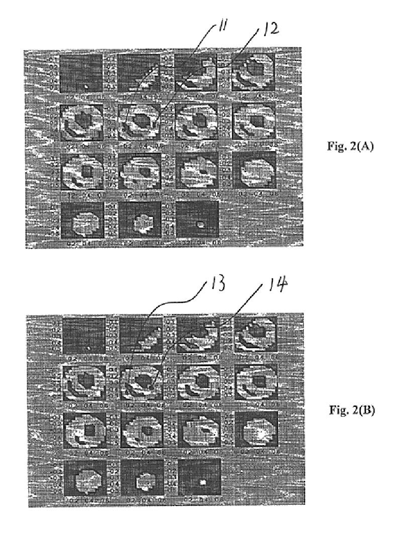 Method and apparatus of three dimension electrocardiographic imaging