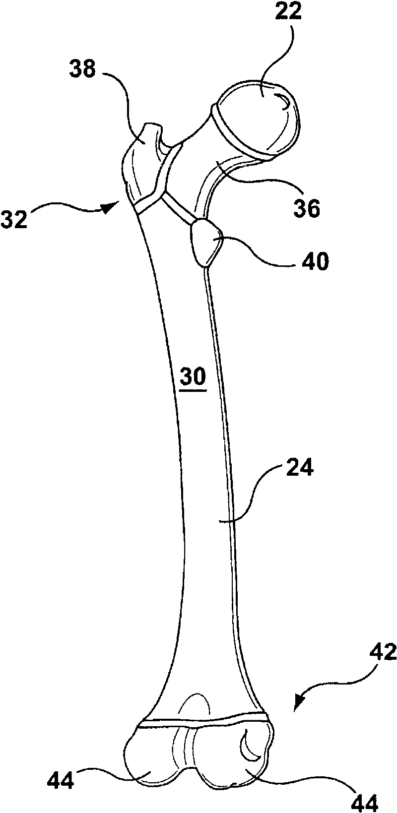 Patient-specific surgical guidance tool and method of use