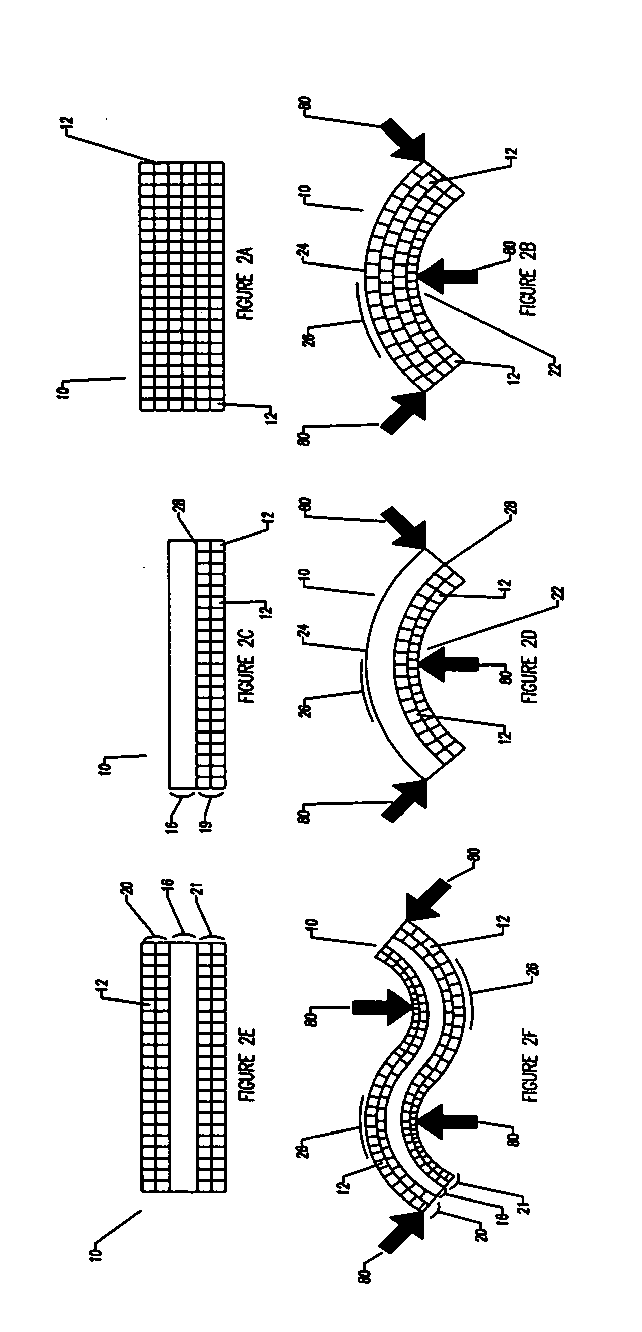 Compliant osteosynthesis fixation plate