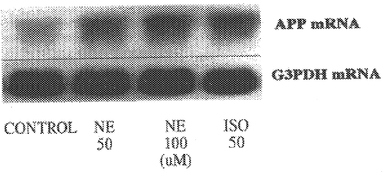 Compositions and methods for treatment of neurological disorders and neurodegenerative diseases