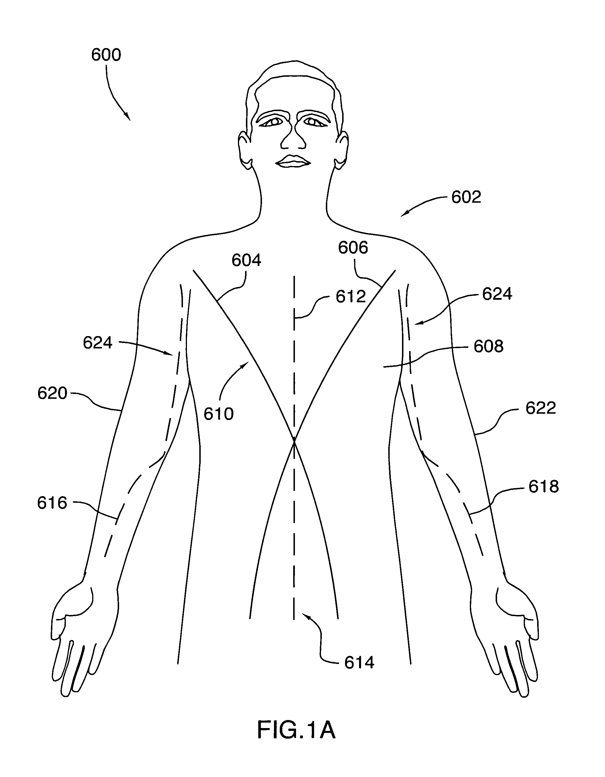 Orthopedic support garment