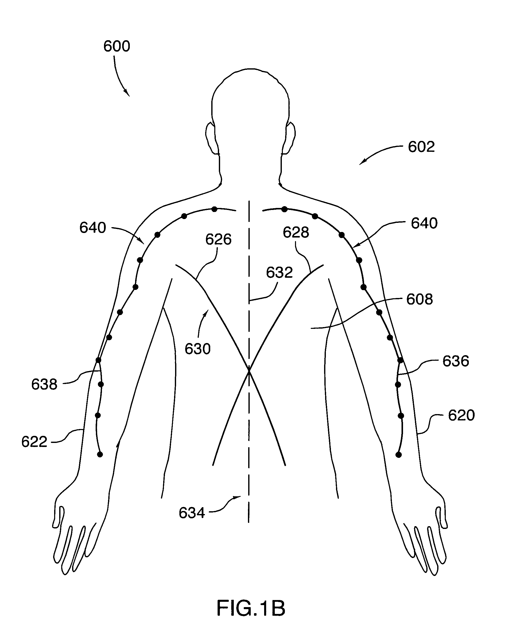 Orthopedic support garment