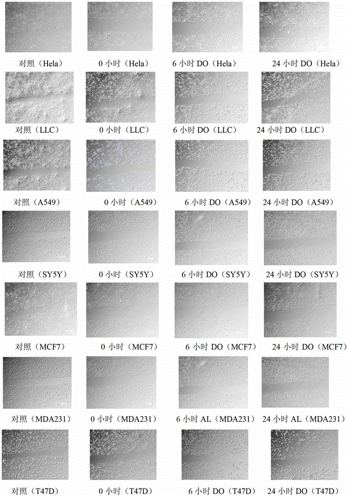 Application of 3,4-Dihydroxyphenylacetic acid in preparing antitumor drug