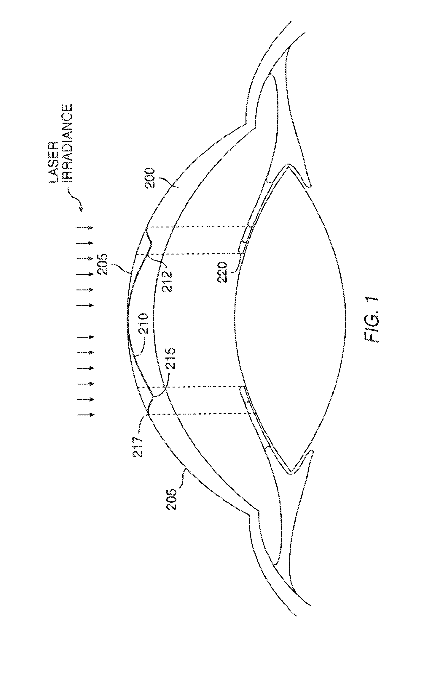 Method and Systems for Laser Treatment of Presbyopia Using Offset Imaging