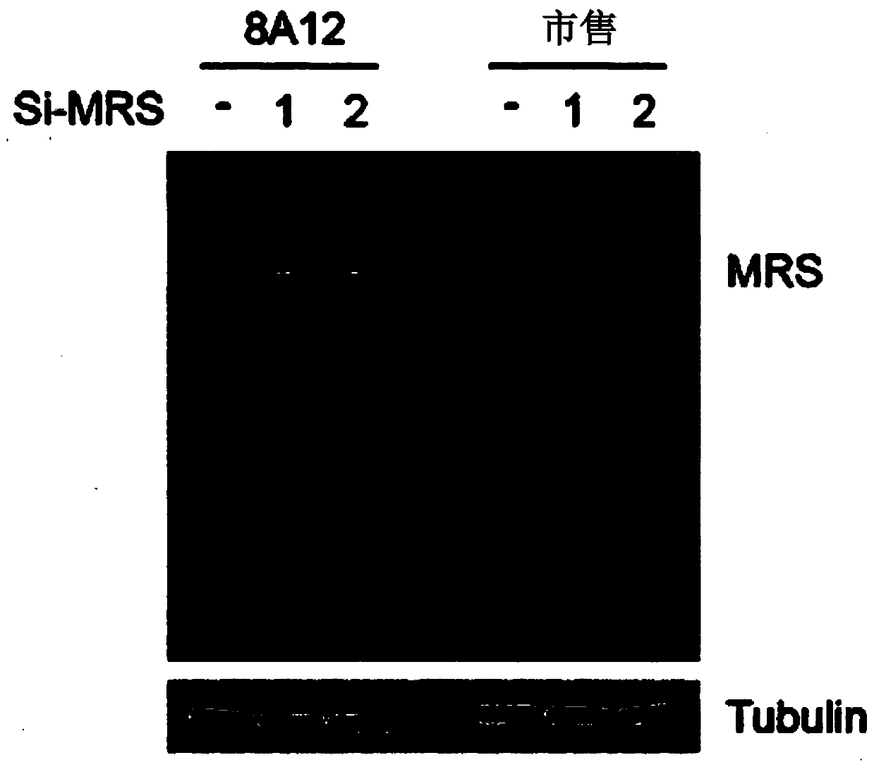 Method for diagnosis of bile duct cancer using methionyl-trna synthetase in bile duct cell