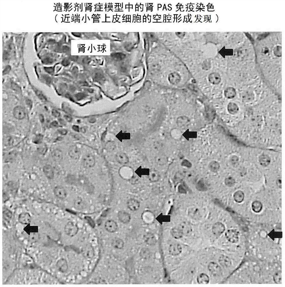 Utilization of cilastatin in inhibiting renal disorder