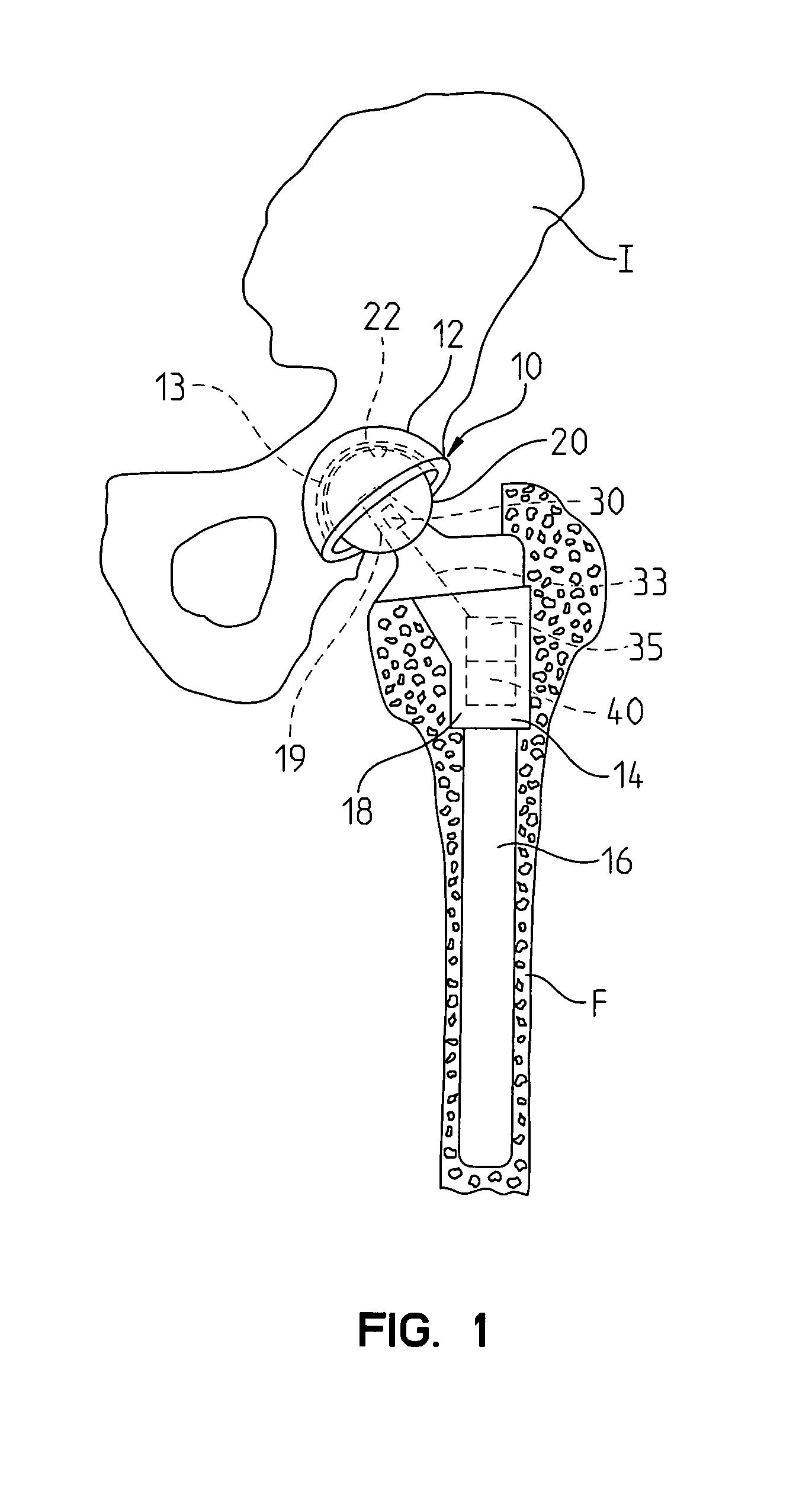 Joint endoprosthesis with ambient condition sensing