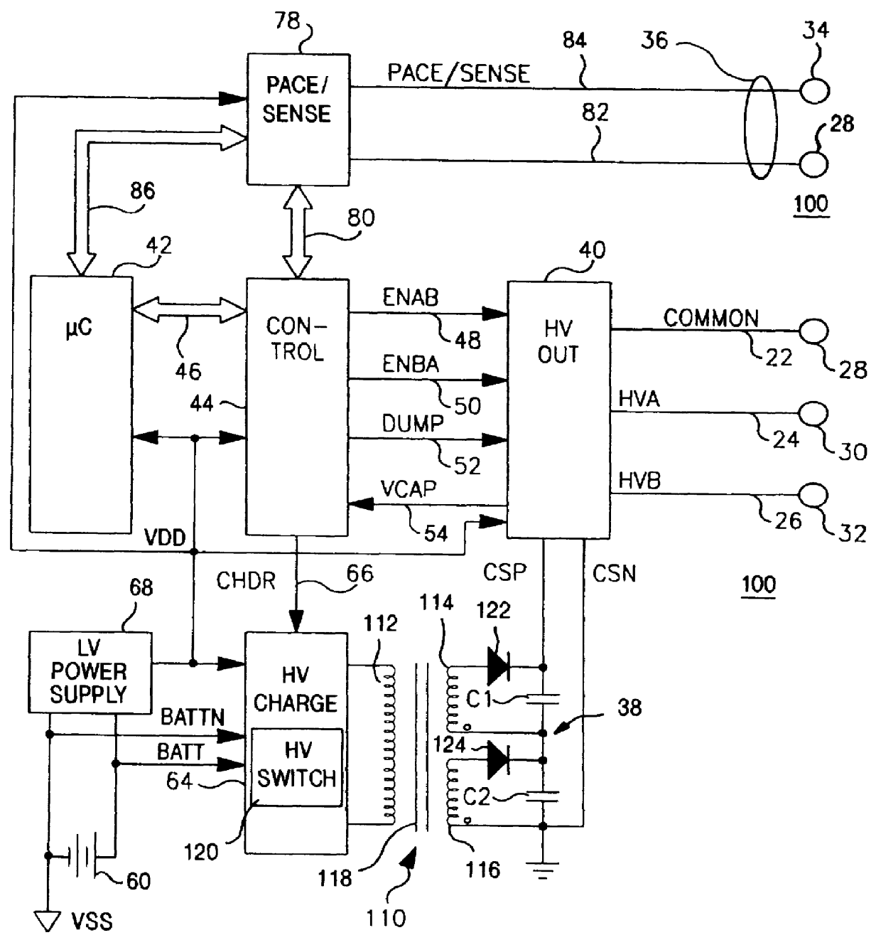 Implantable medical device incorporating distributed core, step-up transformer