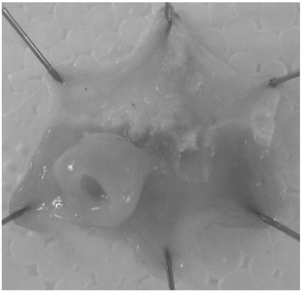 A method for establishing a mouse gastric cancer model