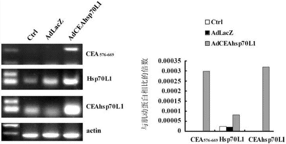 Fusion protein gene-carried recombinant adenovirus and preparation method and applications thereof