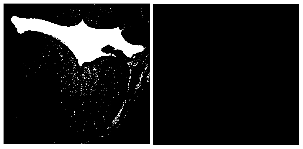 Application of DNA methyltransferase inhibitor to construction of neural tube defect mouse model