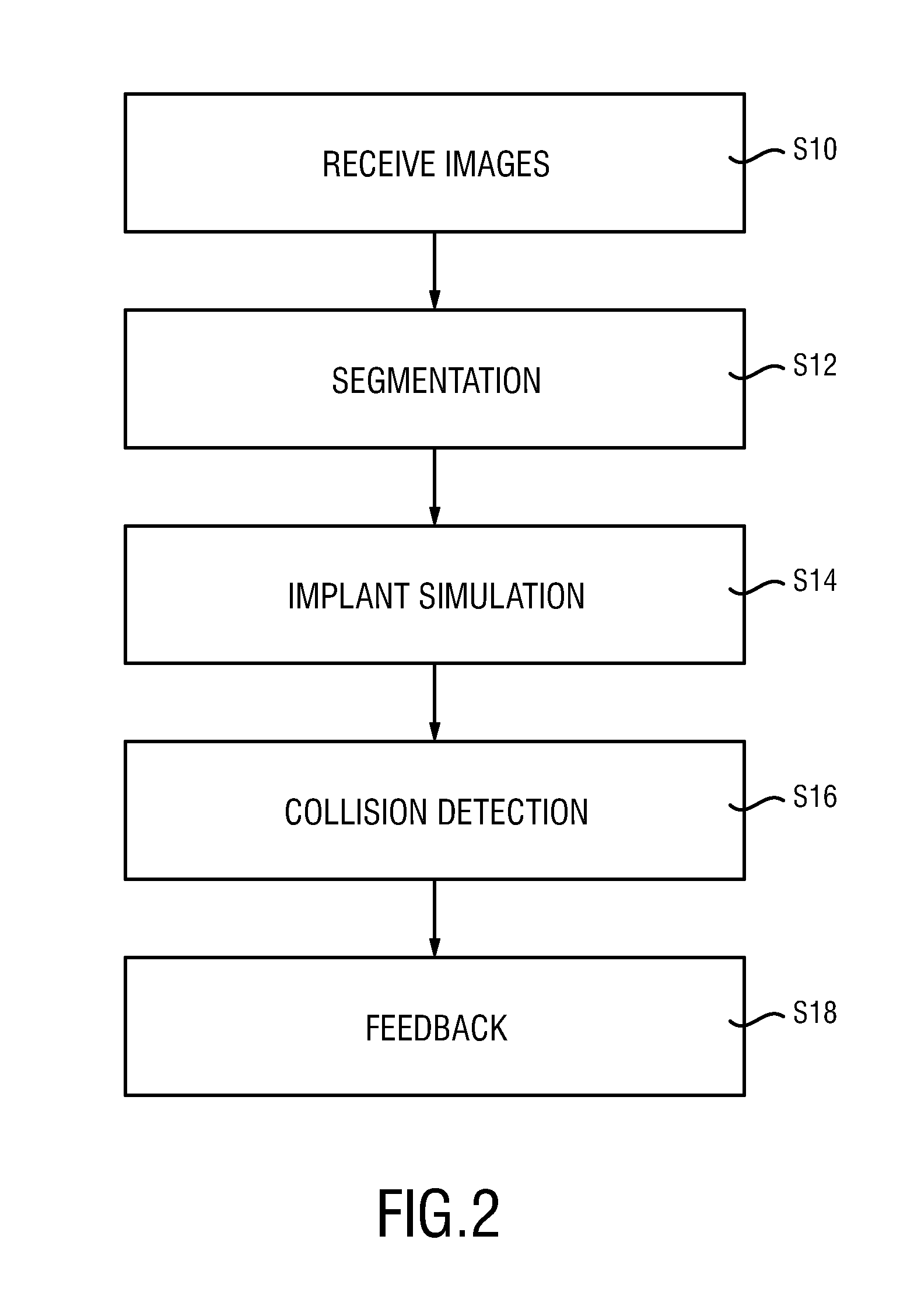 Planning an implantation of a cardiac implant